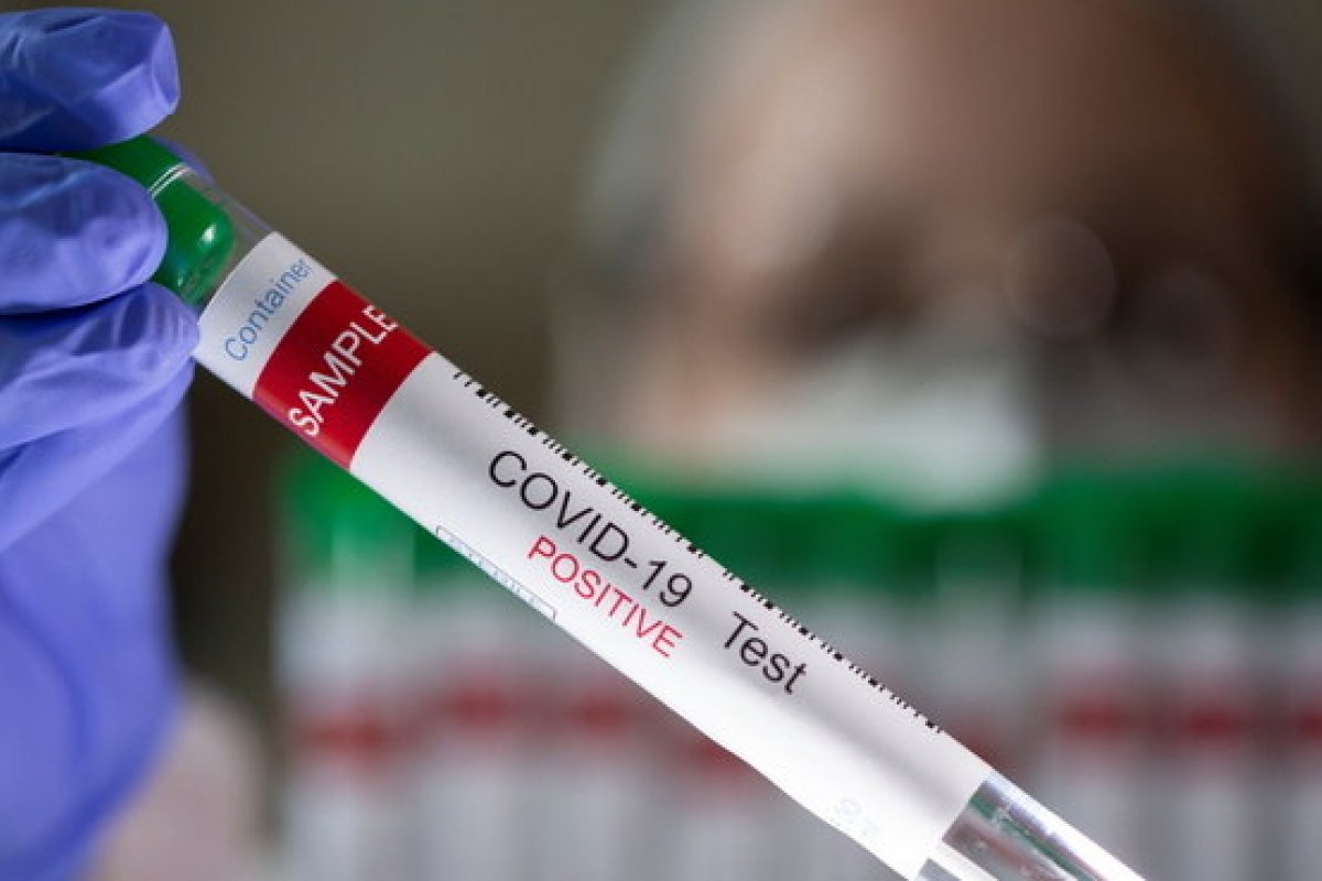 OMS pede colaboração de países para investigar origens do novo coronavírus