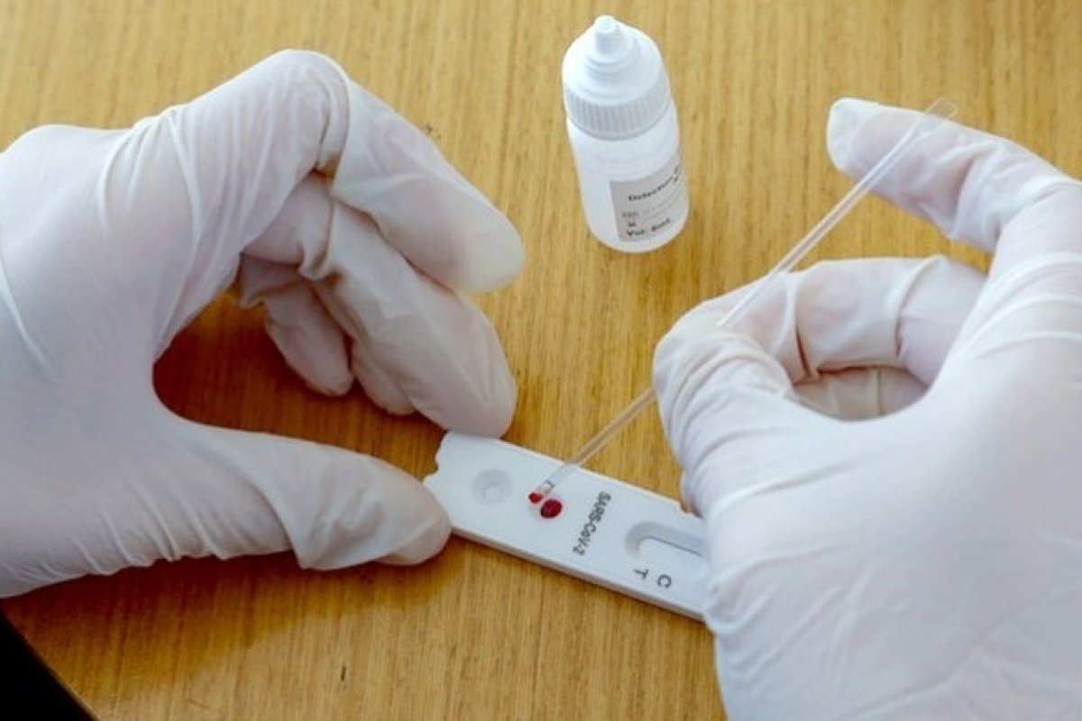 Covid-19: 47 mil casos detectados em Salvador por testes rápidos