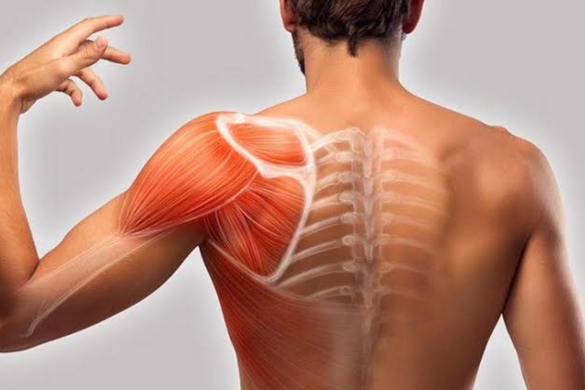 Dor no ombro em atividades cotidianas pode ser sinal da síndrome do impacto do ombro