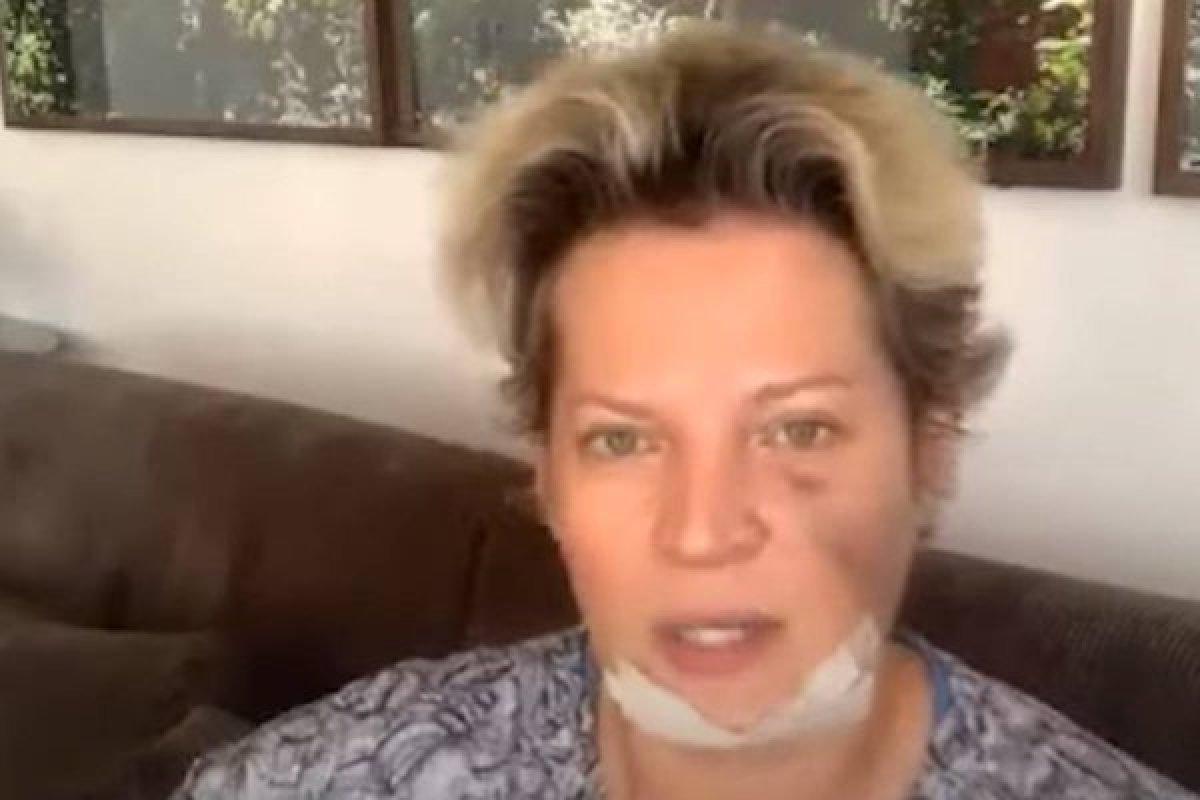 Hasselmann registra novo B.O e diz não confiar na Polícia Federal para investigar suposto atentado