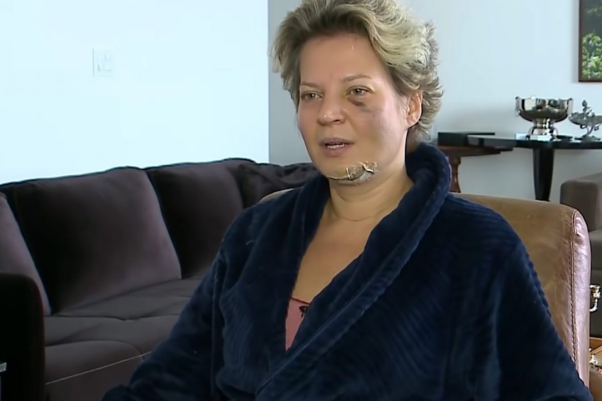 Caso Hasselmann: Polícia Legislativa encerra perícia e envia inquérito ao MPF