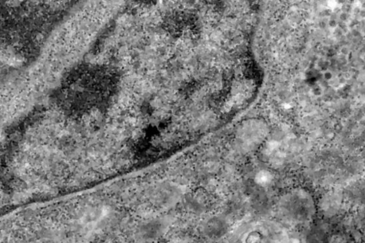 Pesquisa detecta coronavírus pela análise de retina