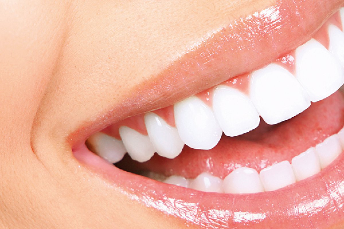 Sorriso gengival pode ser resolvido de forma definitiva com a cirurgia ortognática