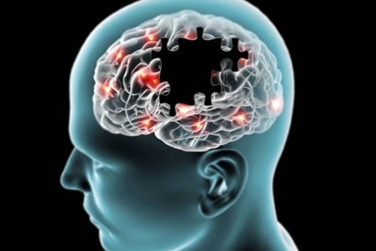 Tecnologia permite diagnosticar demência com apenas uma única bateria de exame
