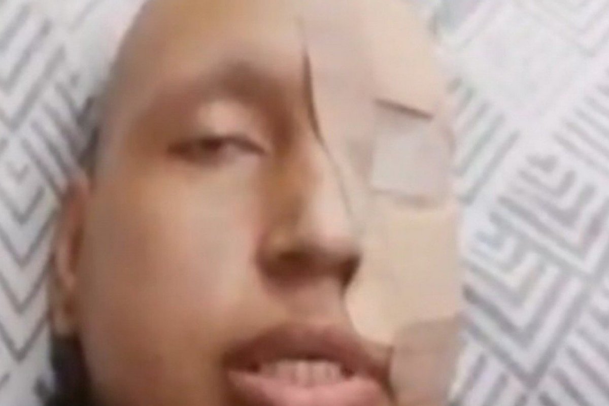 Mulher é suspeita de forjar câncer para arrecadar R$ 50 mil em doações através de vaquinhas virtuais