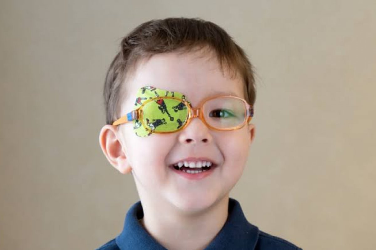 Estrabismo na infância não deve ser negligenciado, aponta estudo