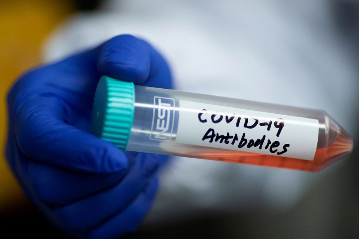 Tempo de duração de vírus e anticorpos