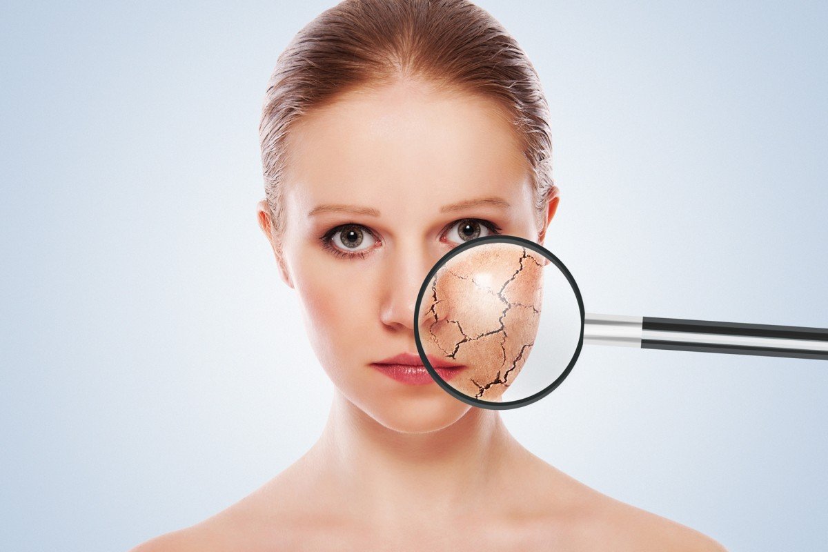 Esfriou? Fique de olho no cuidados com a pele no inverno