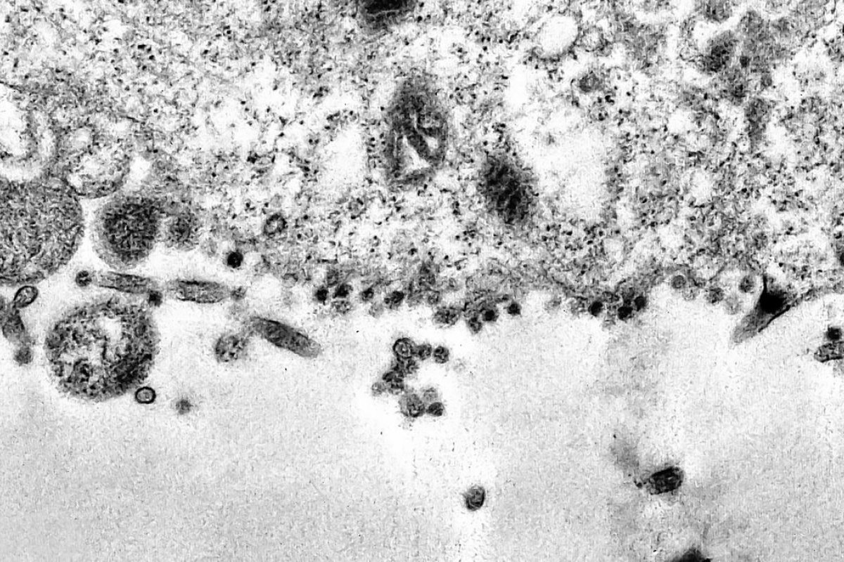 África do Sul detecta nova variante do coronavírus e estuda mutações