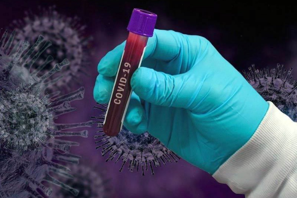 Covid: 1,8 milhão de testes vencidos seguem parados sem previsão de troca