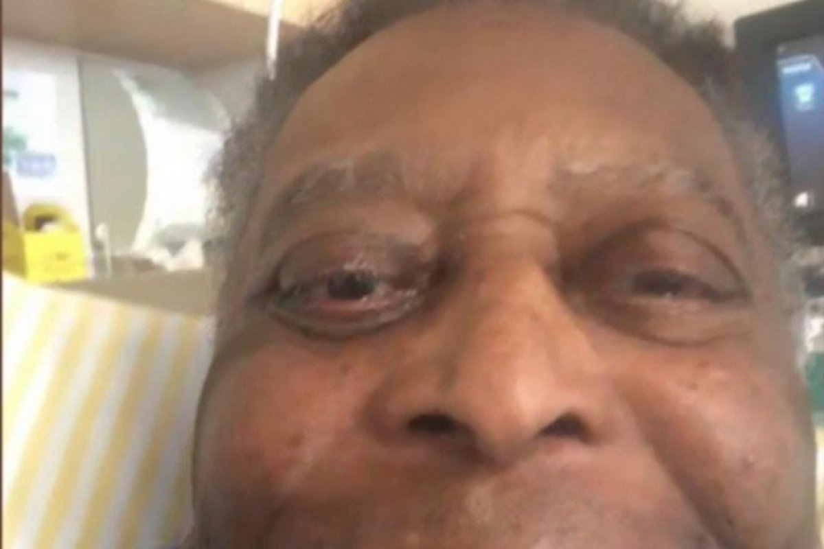 Pelé recebe alta de UTI e vai para quarto após retirar tumor no cólon