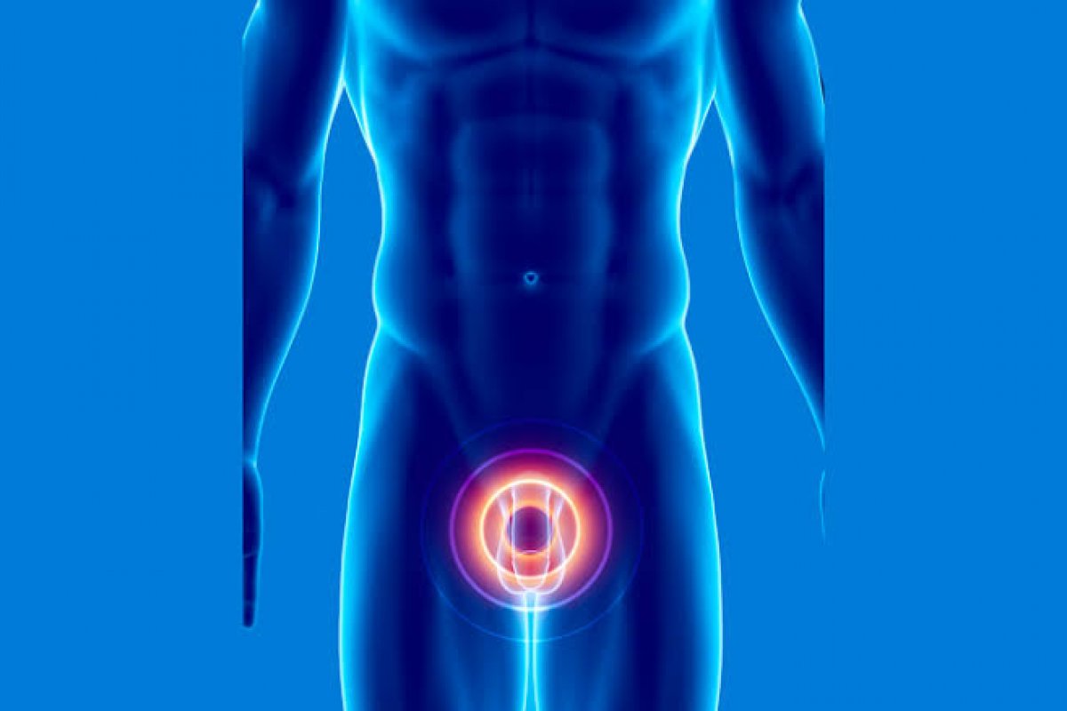 Conheça os novos tratamentos da Hiperplasia Benigna: um dos problemas mais comuns de próstata