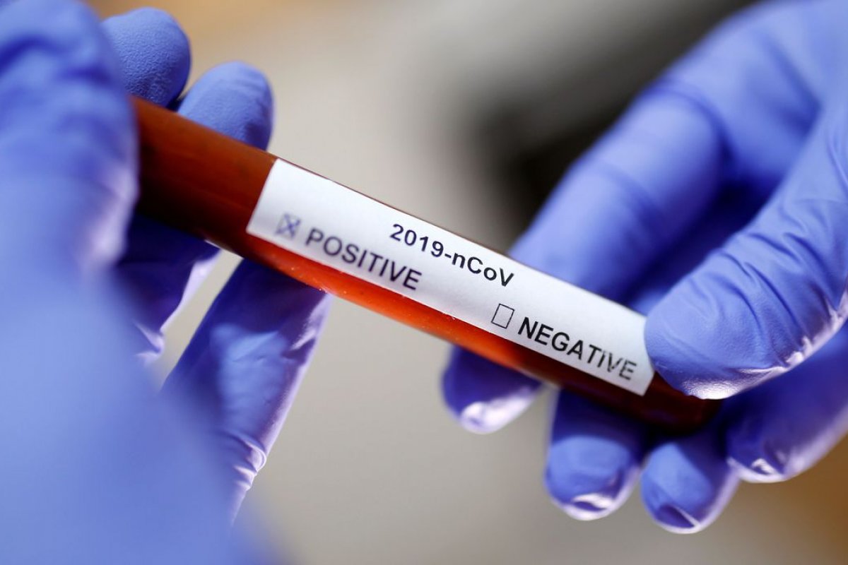 Covid-19: Brasil registra 484 novos óbitos