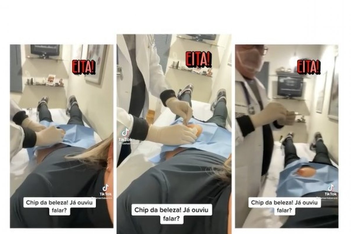 Implante de chip da beleza não é aprovado e pode causar alteração no clitóris e mudança na voz