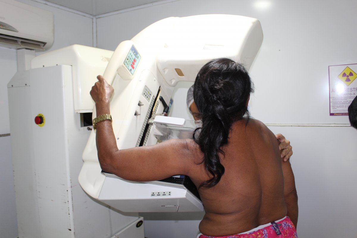 Câncer de mama: diagnóstico precoce amplia em até 95% as chances de cura da doença