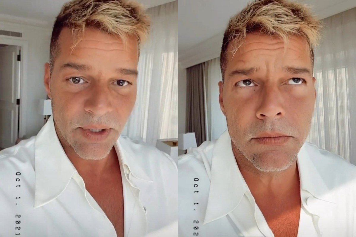 Após surgir com o rosto inchado, Ricky Martin nega procedimentos estéticos