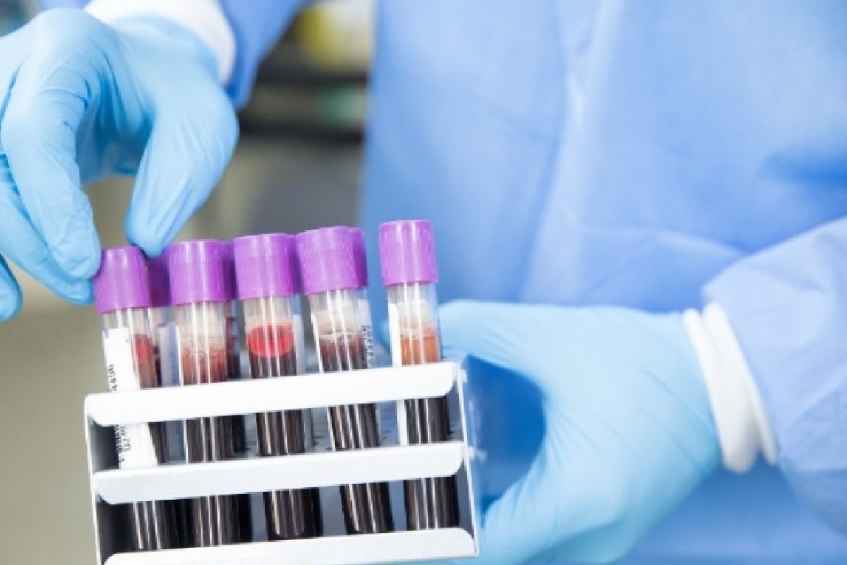 Bahia registra 190 novos casos da Covid-19 nas últimas 24 horas