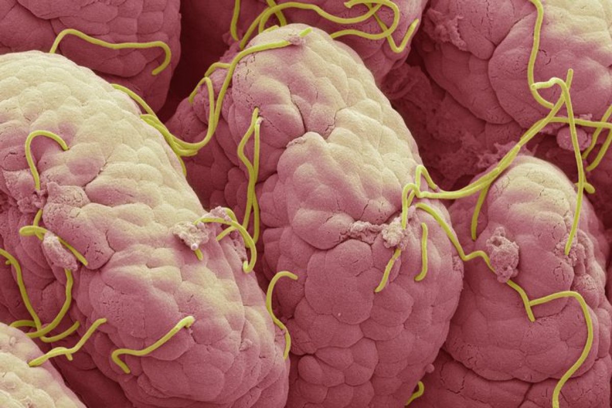 OMS anuncia grupo que estudará o surgimento de novos patógenos