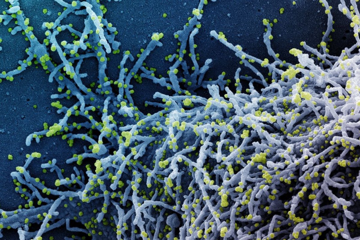 Estudo revela equipamento capaz de calcular probabilidade de uma pessoa desenvolver caso agravado de Covid-19