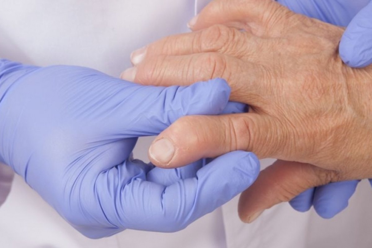 Doenças reumáticas podem acometer pessoas de todas as idades, alerta SBR