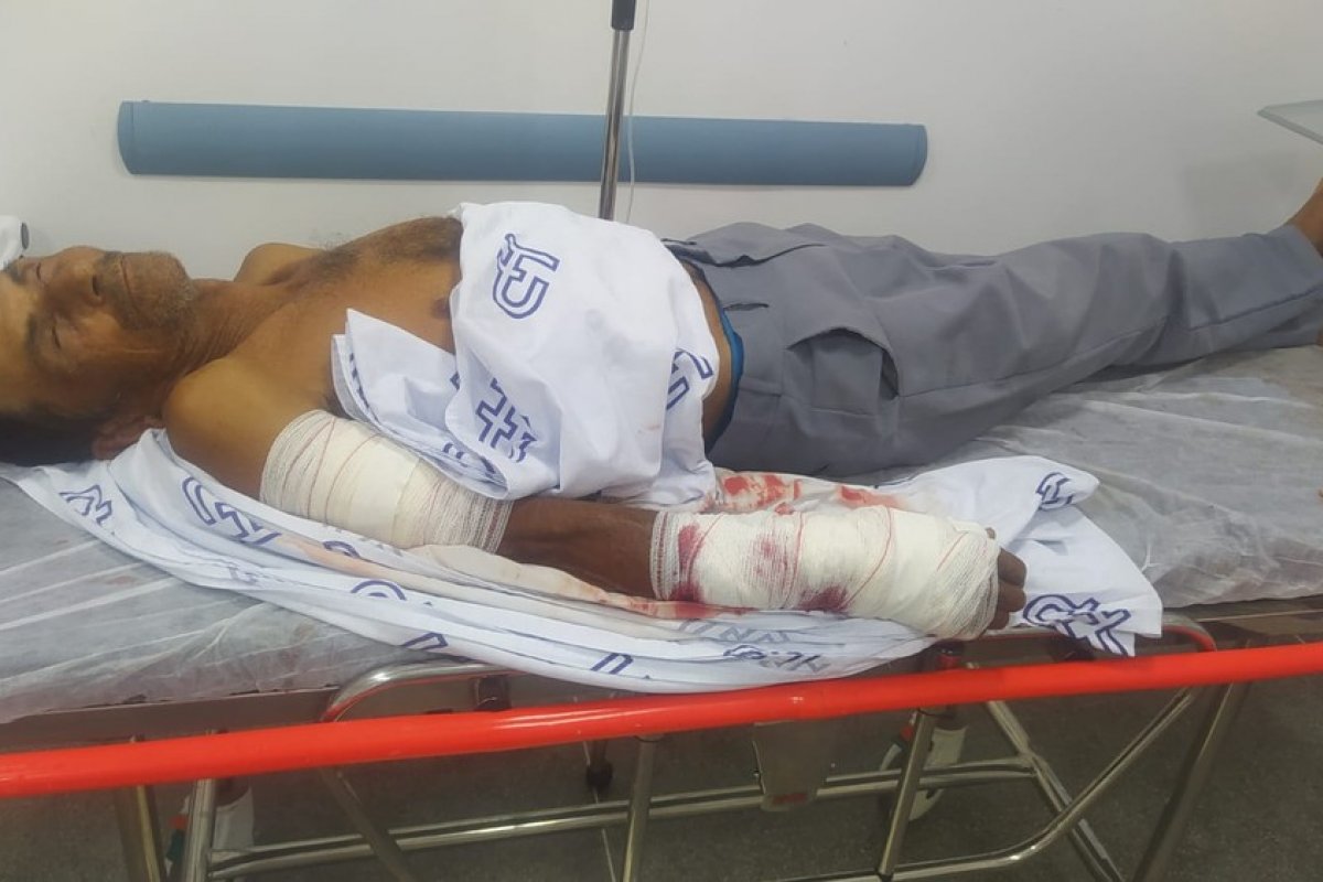 Idoso é internado no HGE após ser atacado por cão da raça pitbull na Bahia