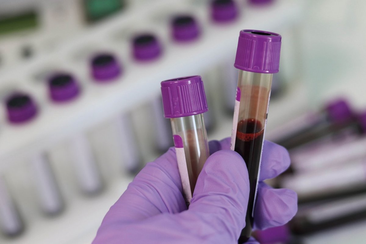 Bahia registra 188 novos casos da Covid-19 nas últimas 24 horas