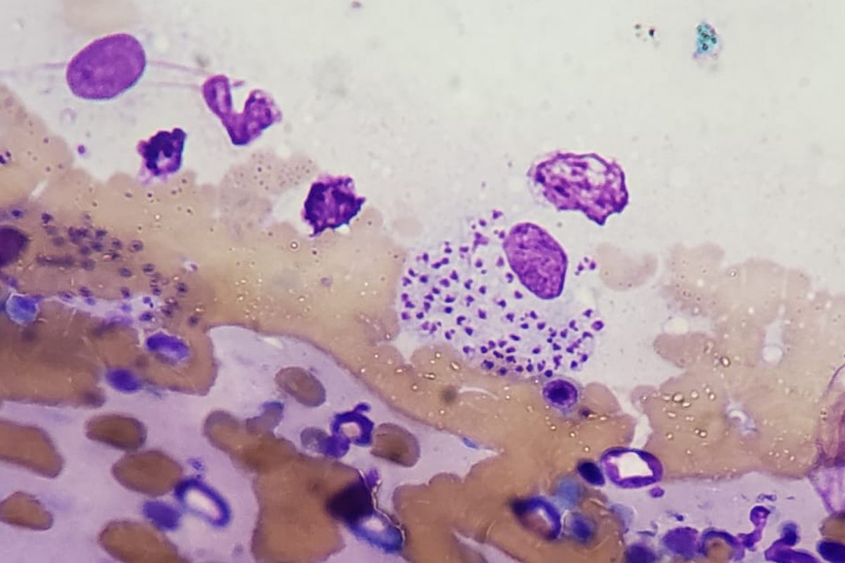 Cientistas brasileiros descobrem parasita responsável por mortes e infecções graves