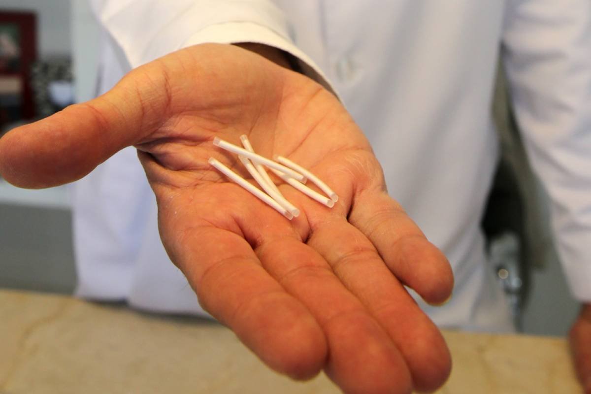 'Chip da beleza': sociedade de endocrinologia não aprova uso dos implantes hormonais