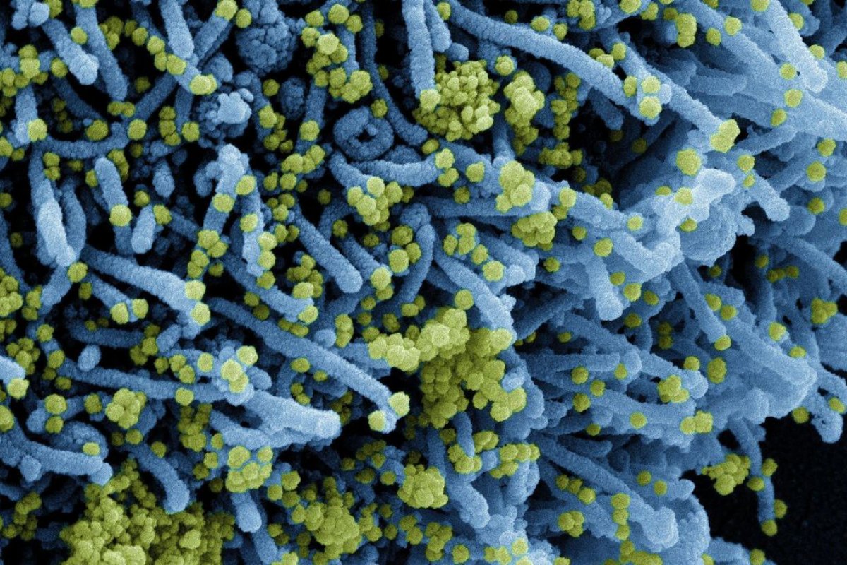 Covid-19: nova variante encontrada na África do Sul coloca OMS e médicos em alerta