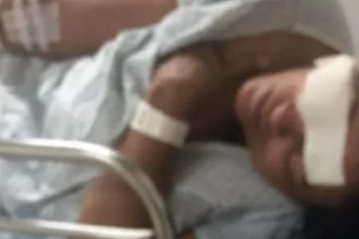 Mulher é atacada pelo companheiro com socos e mordidas em Camaçari, região metropolitana de Salvador