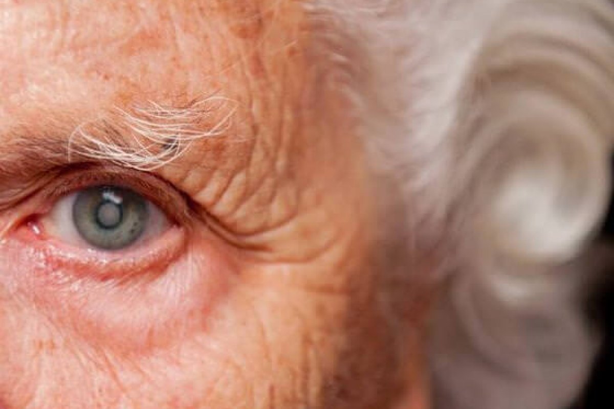 Prevenção e tratamento da catarata devem ser uma preocupação durante o ano todo