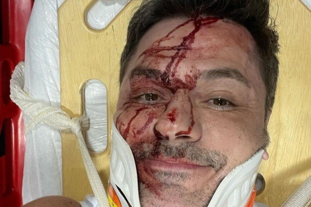 Irmão de Rodrigo Faro sofre acidente de carro em São Paulo
