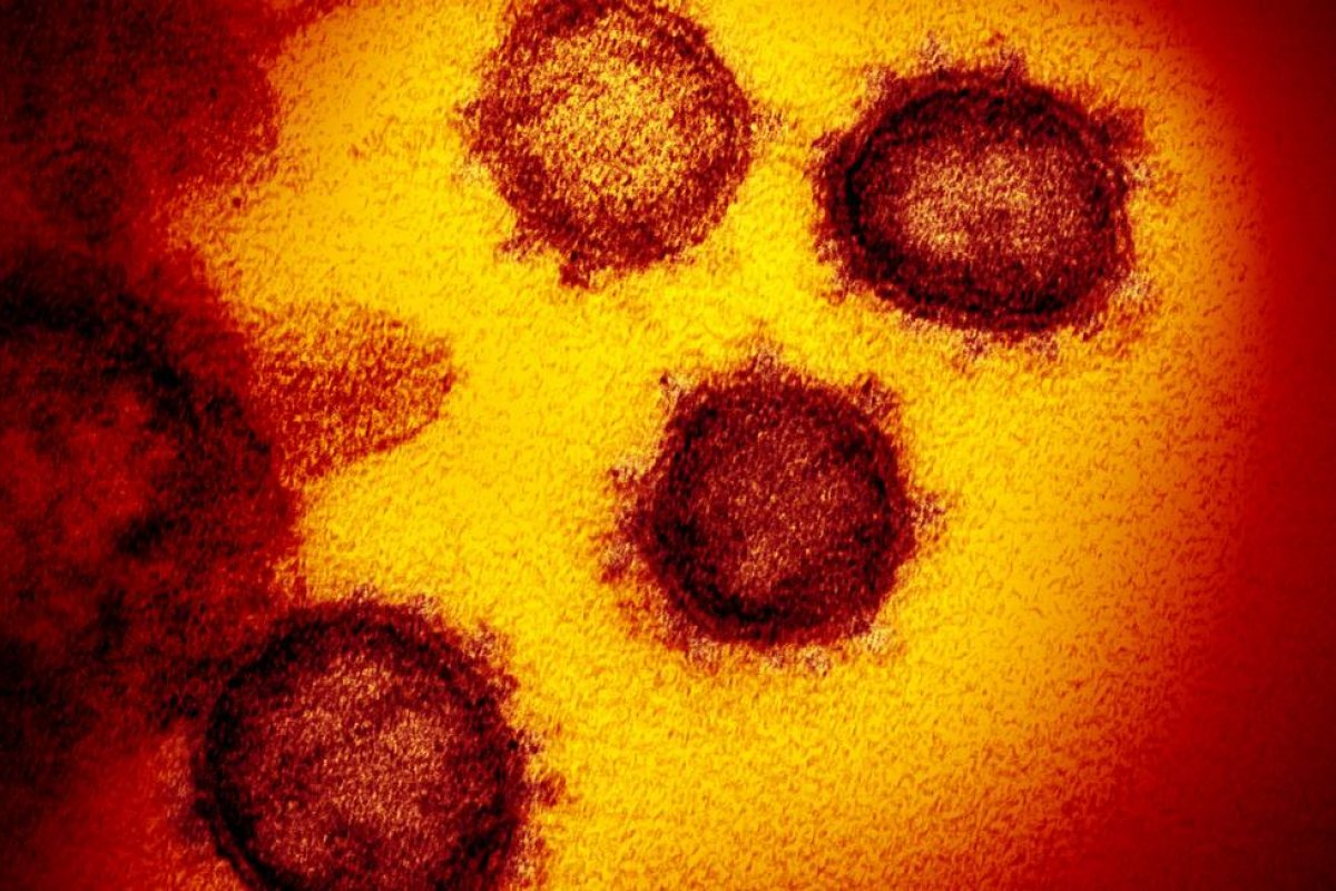 Brasileira recém-chegada da África testa positivo para Covid-19 e é internada