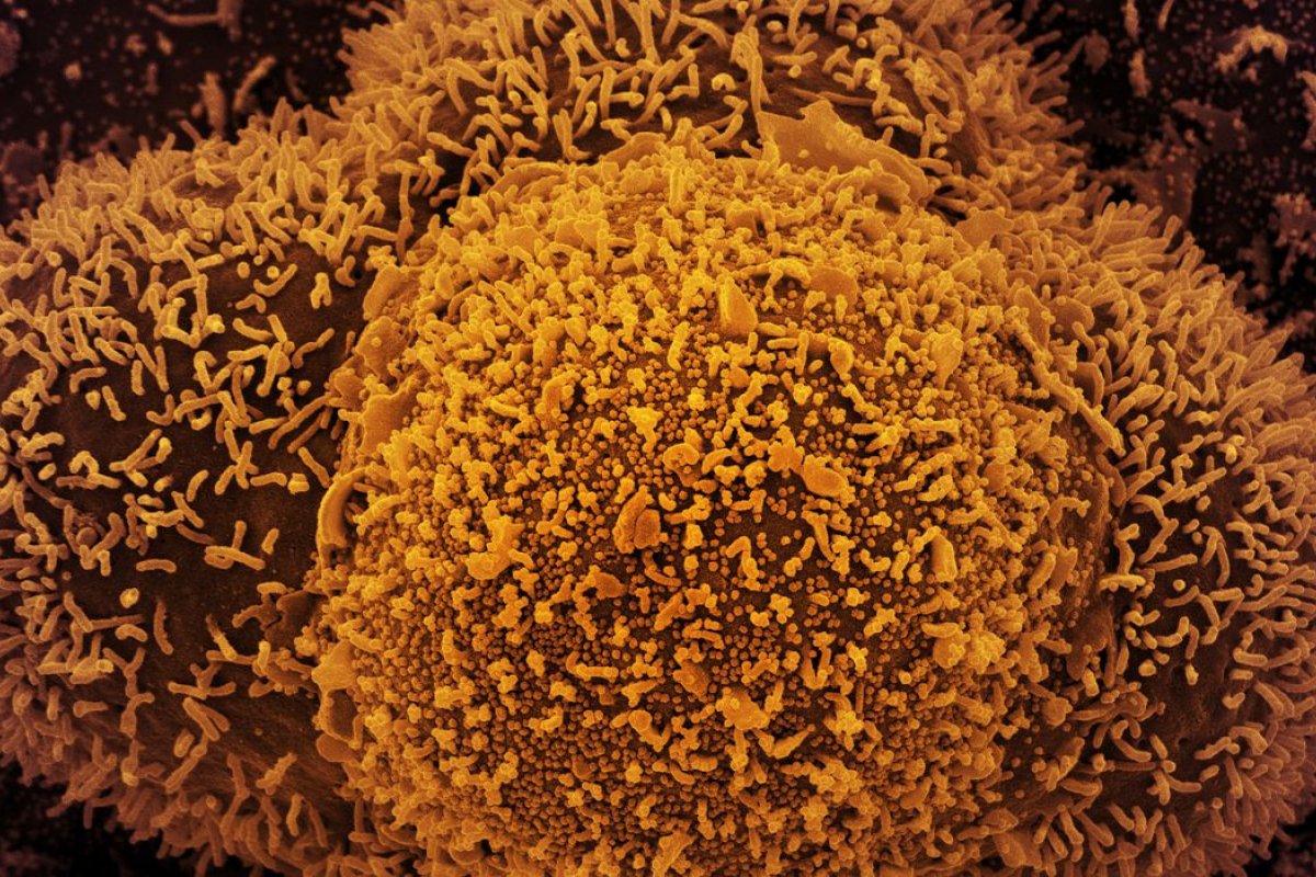 Tendência de transmissão da Covid-19 é estável no Brasil, diz Fiocruz