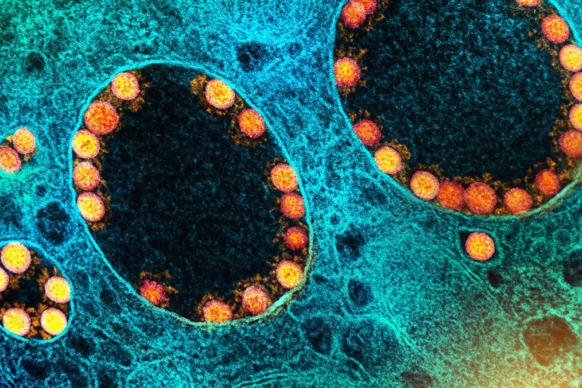 OMS afirma que não há morte vinculada à variante Ômicron até o momento