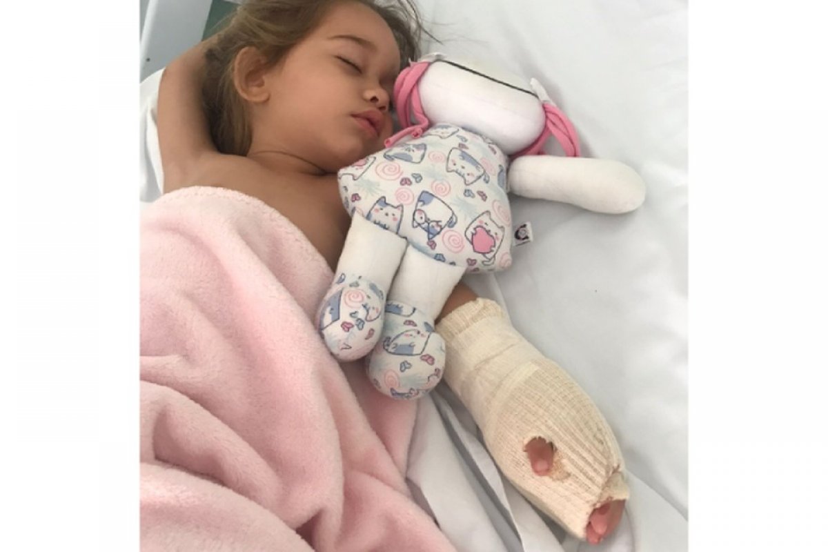 Criança que ficou com a mão presa em escada rolante de loja faz cirurgia para reconstrução dos dedos