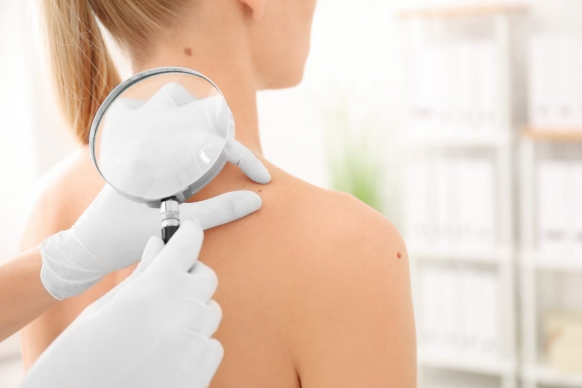 Dezembro Laranja: dermatologista reforça a importância da prevenção do câncer de pele