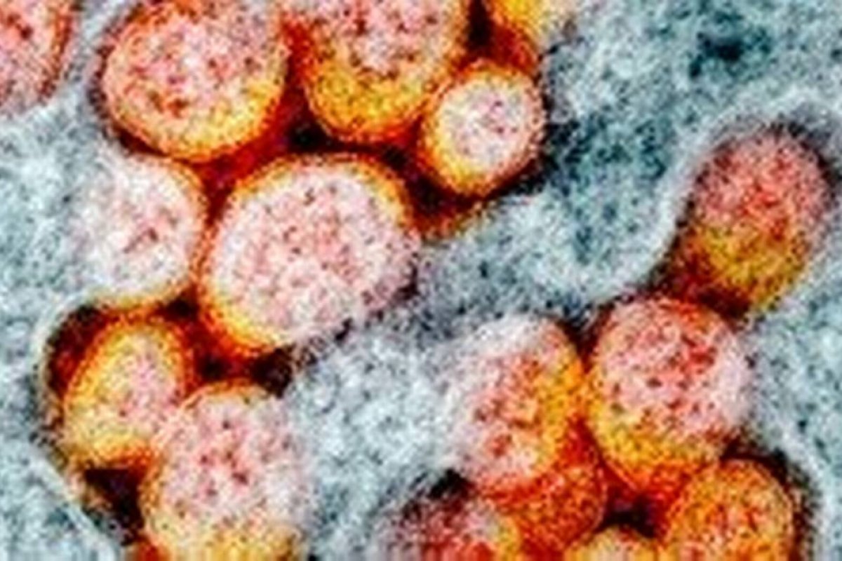 Holanda confirma infecção com variante Ômicron em 18 passageiros vindos da África do Sul