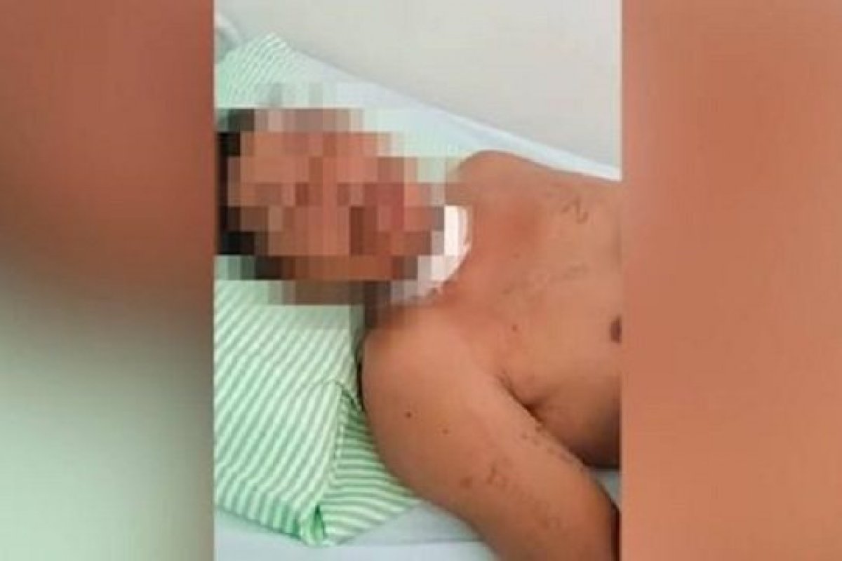 Indígena é enterrado vivo após ser vítima de facadas e golpes corporais