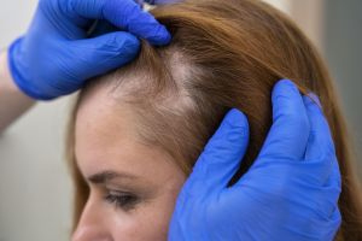 Mesoterapia: entenda tudo sobre a novidade para a recuperação do cabelo