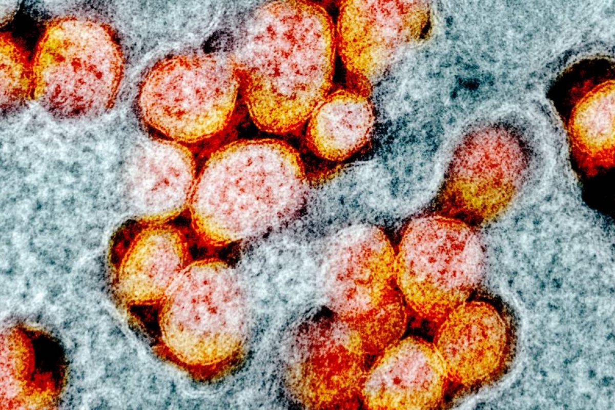 Infecção por Ômicron pode ter 80% menos chance de levar à hospitalização, diz estudo